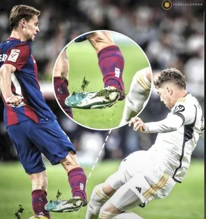 球员在比赛中受伤需要进行治疗 球员在比赛中受伤需要进行治疗